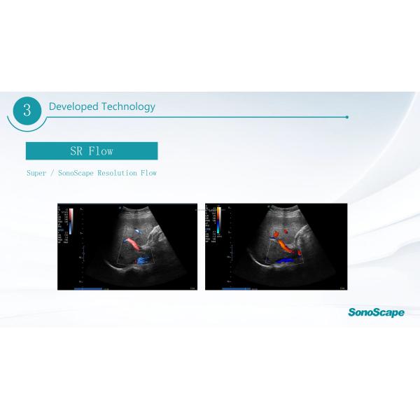 MSK Ultrasound TDI CW Color Sonoscape E2 E3 & Sonoscape E1 Usg