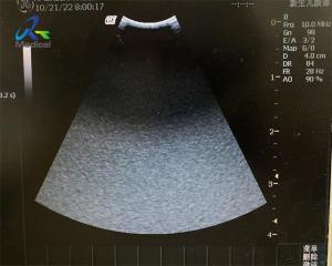 GE 8C-RS Ultrasound Probe Repair Service Acoustic Lens Replacement