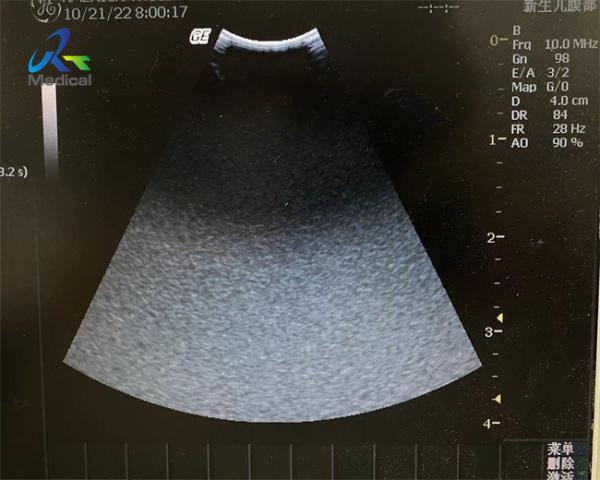 Quality GE 8C-RS Ultrasound Probe Repair Service Acoustic Lens Replacement for sale