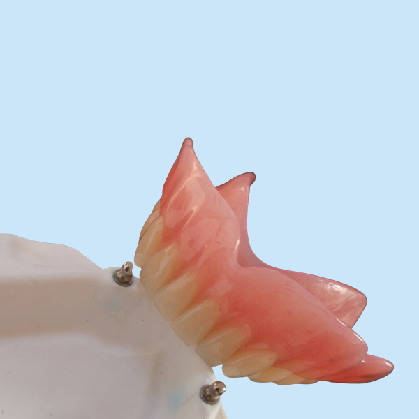 High Biocompatibility Precision Attachment Denture CAD-CAM Implant