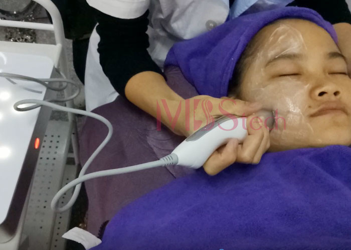 Rf Microneedle Fractional Radio Frequency Machine Face Lift Wrinkle Removal