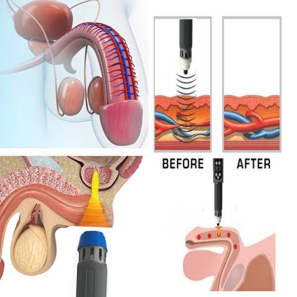 3 In 1 Shockwave Therapy Machine For Pain Relief Sport Injury