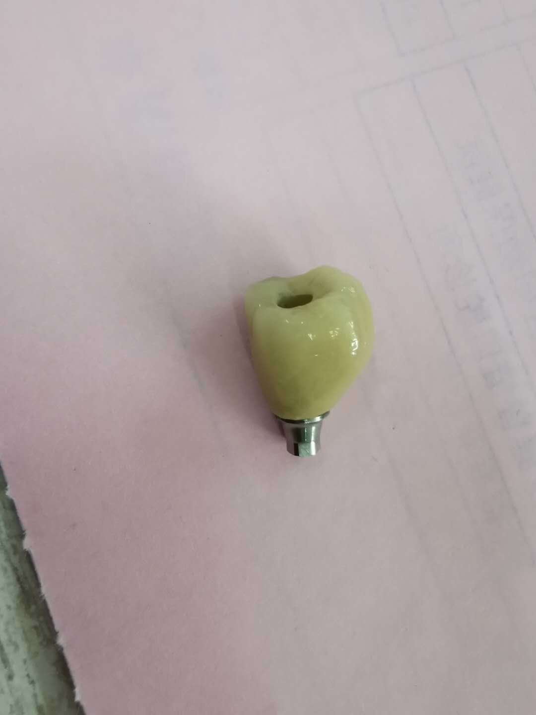 Single Tooth Trushine OSSETEM Dental Implants Fixture Level