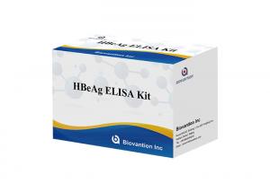 China Human HBeAg Elisa Test Kit Blood Hepatitis B Envelope Antigen Test on sale