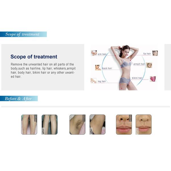 NUBWAY OEM hot selling big spot size 12*20mm 810nm laser hair removal machine with ce