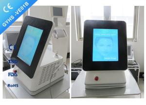 CE Passed Portable Laser Spider Vein Removal Machine 980nm Varicose Veins Removal