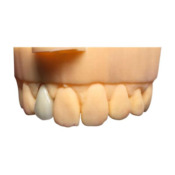 Quality Chromecast Safety PFM Dental Crown Bridge Good Biocompatibility for sale