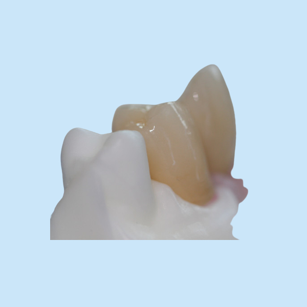 Removable Pure Titanium Dental Implant Bar Custom Abutment