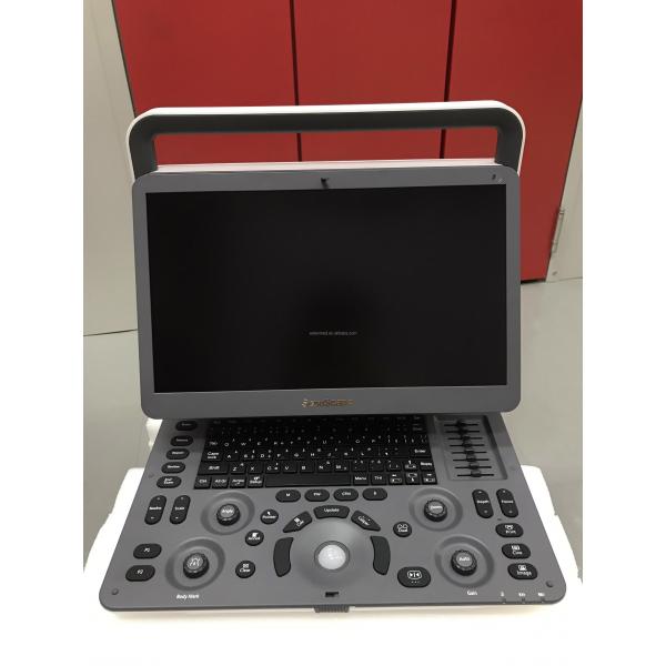 MSK Ultrasound TDI CW Color Sonoscape E2 E3 & Sonoscape E1 Usg