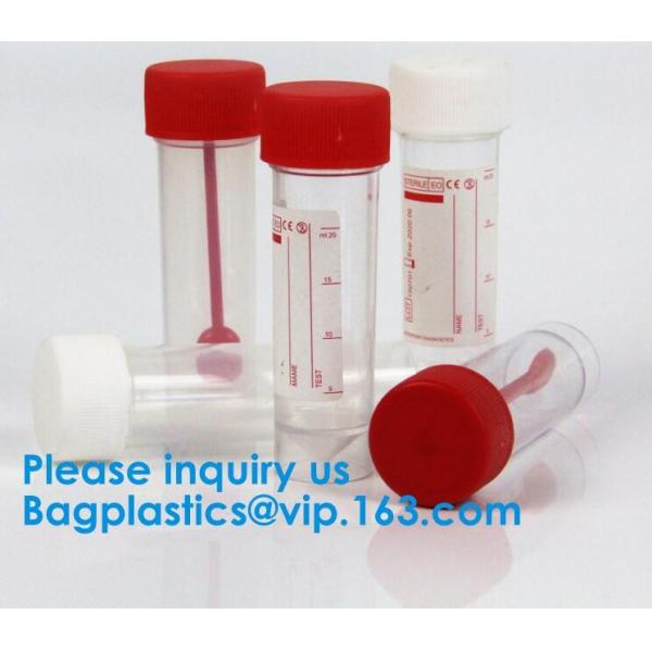 Disposable Urine Specimen Cup/Urine Sample Containers/Urine Collection Cup,Sterile Disposable Hospital Sample 60ml 100