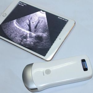 Mini Wireless Ultrasound Machine Probe Wifi Ultrasound Probe