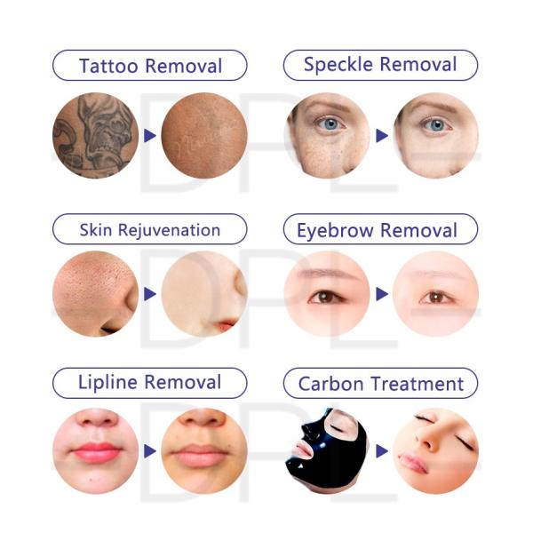 DPL New design most popular active q switched nd yag laser portable device eyebrow removal picosecond machine