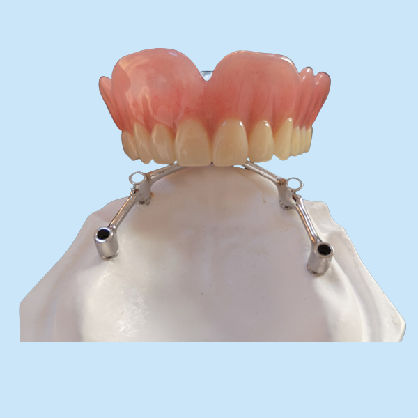 COCR Tooth Implant Crown FDA Dental Implants With Titanium Bar
