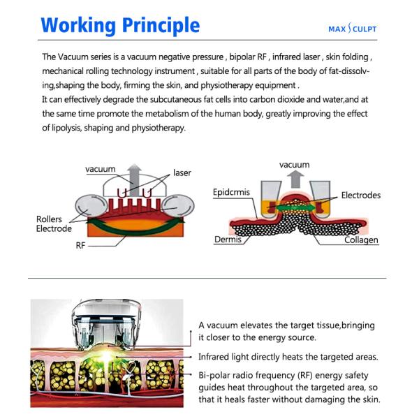 Rf Skin Tightening Vacuum Weight Loss VelaBody Vacuum Cavitation Slimming Radio Frequency Fat Reduction Machine Vacuum Weight Loss Body Contouring Machine