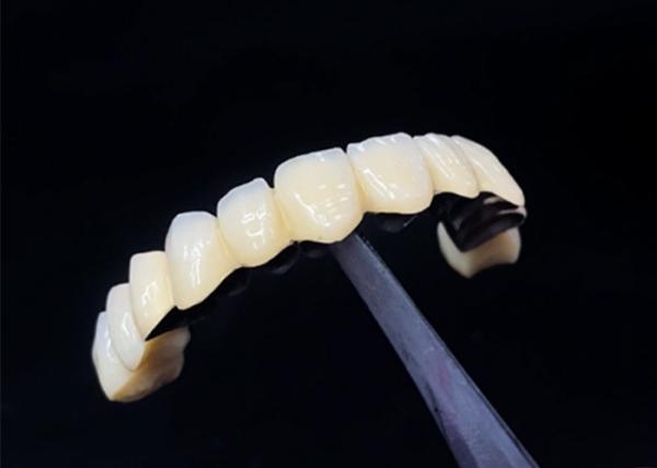 Quality Porcelain Fused To Metal Crown Combining Durability And Beauty For Dental Health for sale