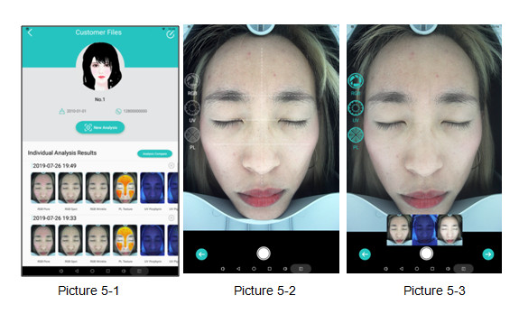 Accurately Analysis Skin Hydration Analyzer With UV Light CE FCC Appoved