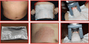 2017 latest high quality and result popular cryotherapy machine for sale