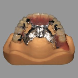 China CoCr Acrylic Cast Metal Partial Combined With Fixed PFM wholesale