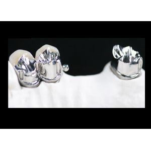 MK1 Precision Attachment Denture for Perfect Fit and Protection