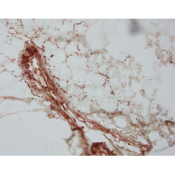 8Tests 20Tests AchE Stain Kit Copper Ferrocyanide Method Baso Brand