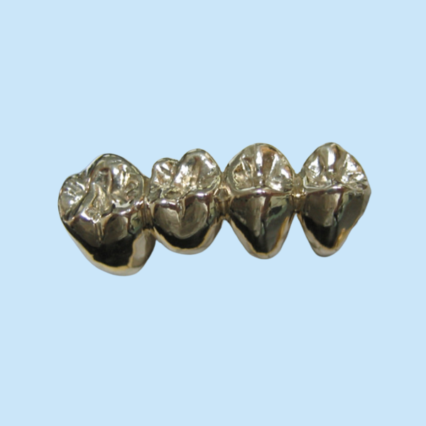 High Stability Semi Precious Dental Crown Bridge PFM Easy Casting