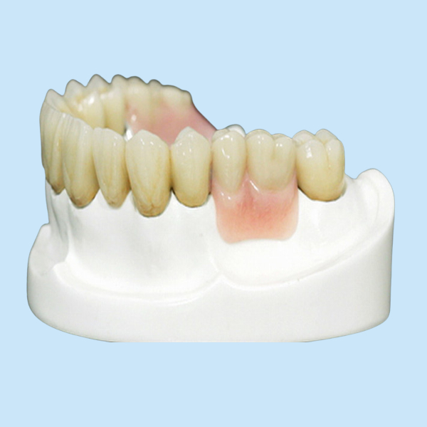 MK1 Precision Attachment Denture for Perfect Fit and Protection
