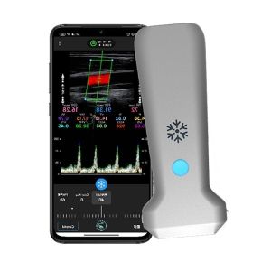 Buy cheap CE Diagnosis And Treatment Home Ultrasound Scanner Mobile 8.3MHz from wholesalers