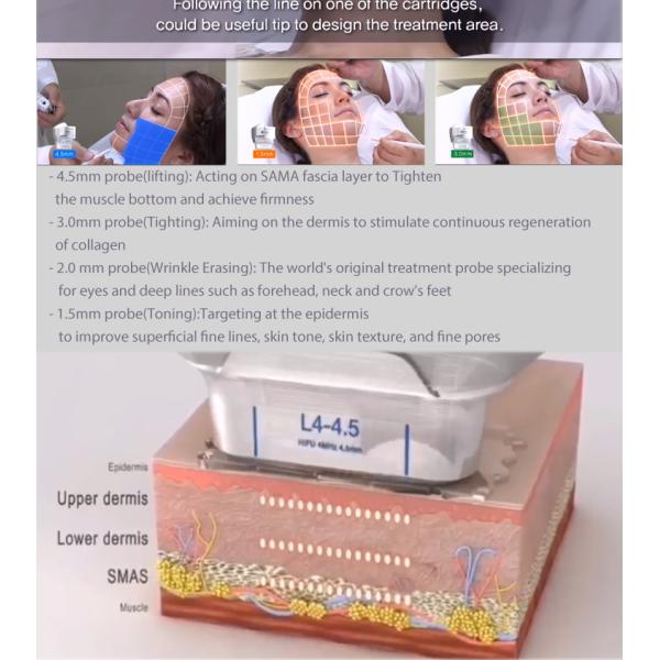 7D Hifu 20000 Shots anti-wrinkle Face Lift Skin Tightening Body Slimming Hifu Double Therapy Face Lift Beauty Hifu Machi