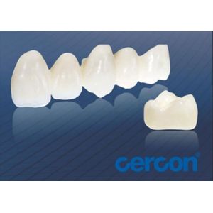 China Wear Resistance CAM Cercon Zirconia Crowns Easy Cleaning High Biocompatibility wholesale