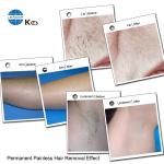 755nm / 808nm / 1064nm Painless Diode Laser Hair Removal Double TEC 3 Wavelength