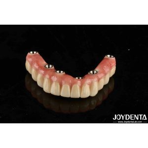 Dental Titanium Malo Implant Bridge Combining Traditional And Modern Techniques