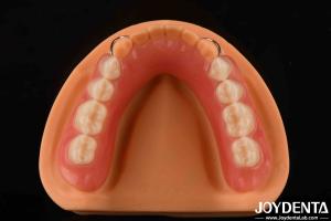 China Personalized Customization Acrylic Denture Finish Lightweight High Elasticity wholesale