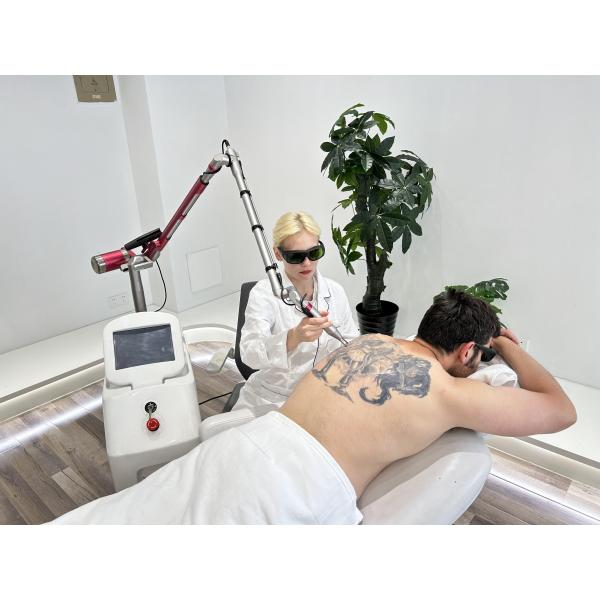 1064nm Q Switched Nd Yag Laser Picosecond Tattoo Removal Machine Stationary Style