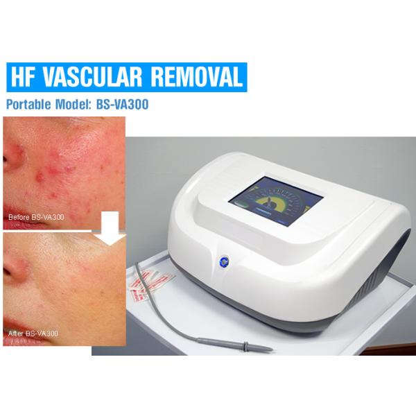 Professional Vascular Removal Machine , Spider Vein Removal Machine High Frequency