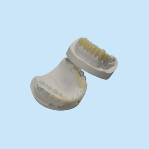 Custom TEMP Porcelain Tooth Crown Inlay Onlay Strong Hardness Veneer