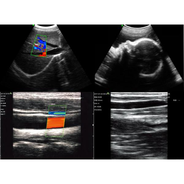 Medical Wireless Ultrasound Probe 128 Elements Color Doppler Ultrasound Wifi