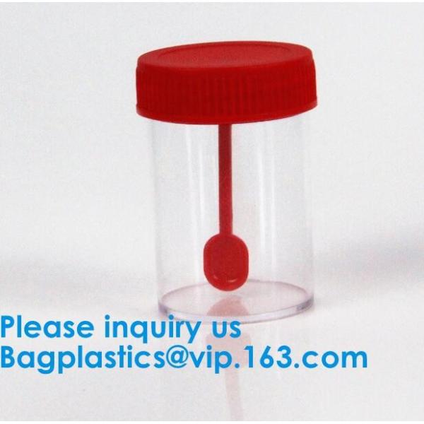 Disposable Urine Specimen Cup/Urine Sample Containers/Urine Collection Cup,Sterile Disposable Hospital Sample 60ml 100