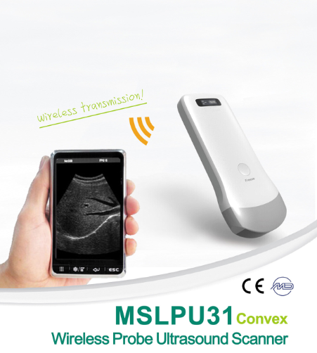 Mini Wireless Ultrasound Machine Probe Wifi Ultrasound Probe