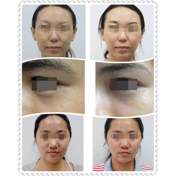  Microcurrent face lifting home beauty equipment.jpg