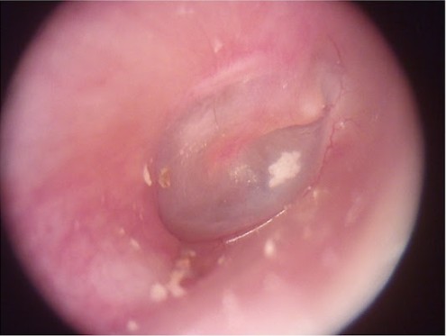 Handheld Digital Inspection Otoscope Ophthalmoscope Dermatoscope With 3.5inch LCD Screen