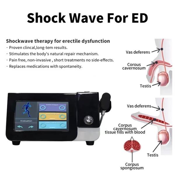 Body Pain Extracorporeal Shockwave Therapy Machine For ED Erectile Dysfunction