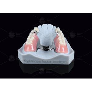 Silver Key And Keyway Attachment Easy Maintenance Precision Attachment Dental