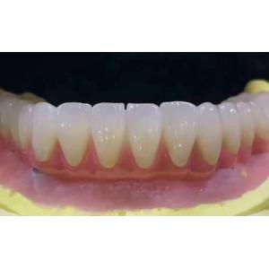 China Customized Dental Zirconia Tooth Crown Stain Resistant With High Precision wholesale
