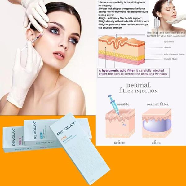 Deep Fine Neck Wrinkles Revolax Hyaluronic Acid Korea Dermal Filler For Forehead Lines