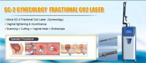 China Vagina loosing and vagina health care of fractional co2 rf laser machine wholesale
