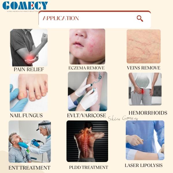 Gomecy Newest Medical 980nm 1470nm 635nm Diode Laser System for Endolift Wound Healing and Anti-inflammatory Treatments