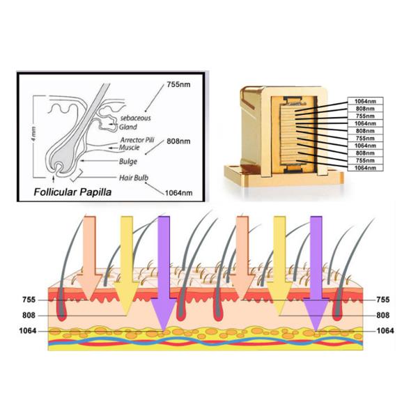 Vertical Triple Wavelength Diode Laser Hair Removal System