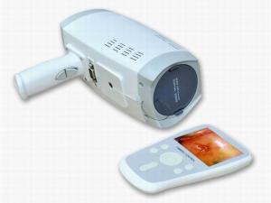 China Lens Resolution 800000 Pixels Digital Electronic Colposcope With Automatic Electronic Shutter 3.5 Inch Handheld Screen wholesale
