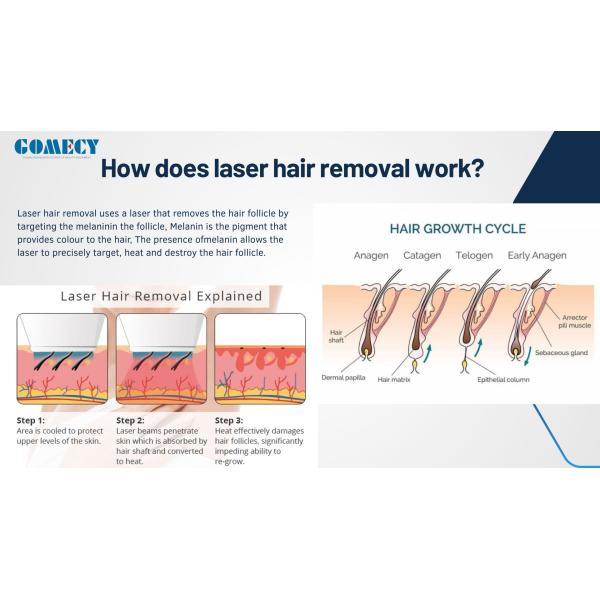 AI Skin Analyzer Skin Rejuvenation Hair Removal 4 Wavelength Diode Laser 755 808 940 1064nm Ice Diode Laser Hair Removal Machine