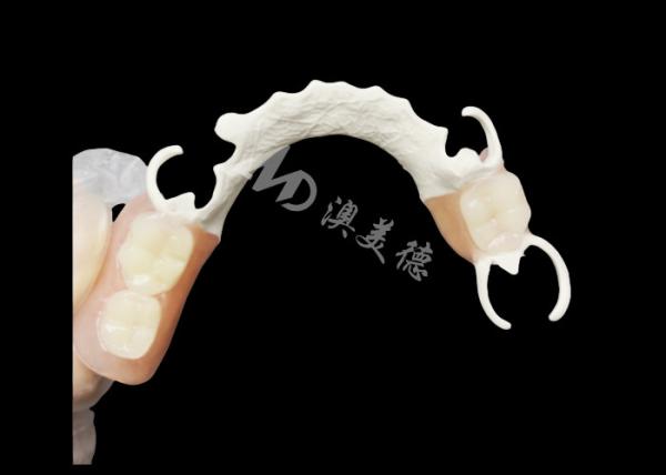 Quality Custom Cast Partial Denture with HPP framework for Enhanced Chewing and Speech for sale